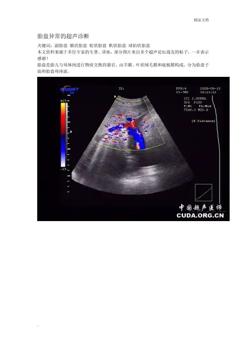 胎盘异常的超声诊断