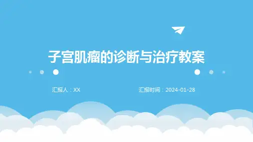 子宫肌瘤的诊断与治疗教案