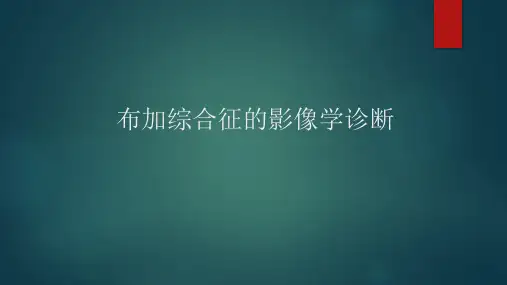 布加综合征医学PPT