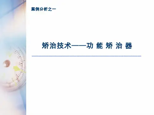 矫治技术——功 能 矫 治 器