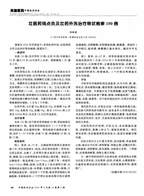 壮医药线点灸及壮药外洗治疗带状疱疹150例