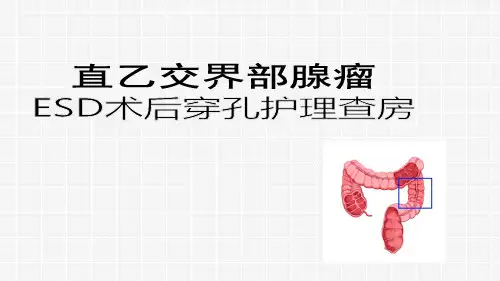 结肠息肉护理查房PPT参考课件