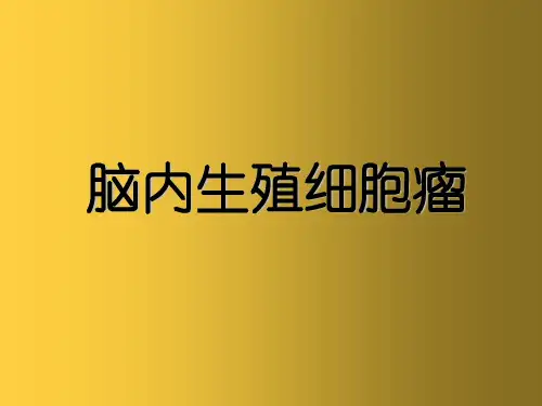 脑内生殖细胞瘤影像