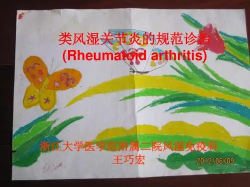 类风湿关节炎的规范诊治PPT课件