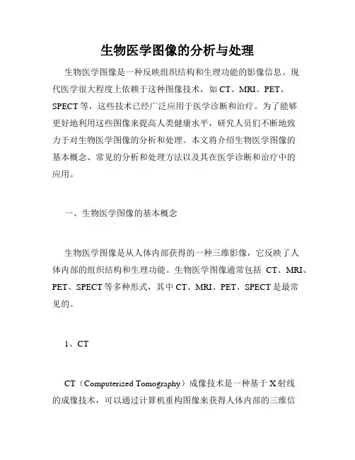 生物医学图像的分析与处理