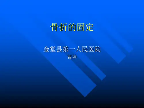 骨折的固定