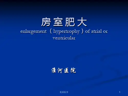 心电图 房室肥大(清晰详实)