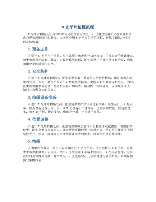 x光牙片拍摄流程