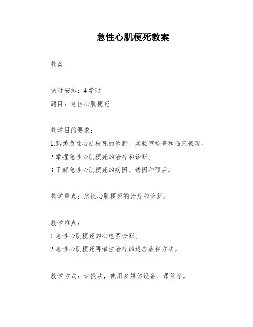 急性心肌梗死教案