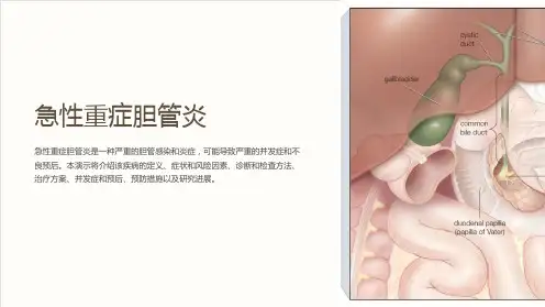 急性重症胆管炎