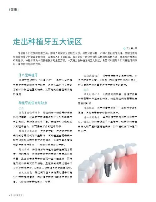 走出种植牙五大误区