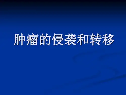 肿瘤学 06-肿瘤的侵袭和转移