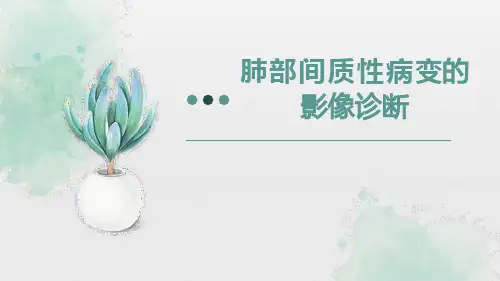 肺部间质性病变的影像诊断