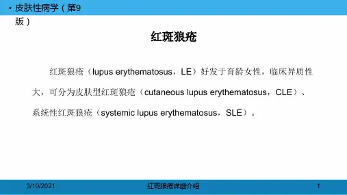 红斑狼疮详细介绍培训课件