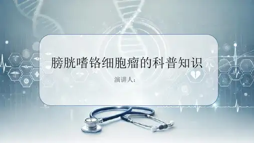 膀胱嗜铬细胞瘤的科普知识PPT课件