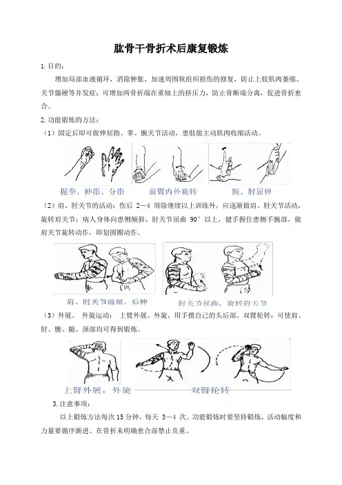 肱骨干骨折术后功能锻炼指导