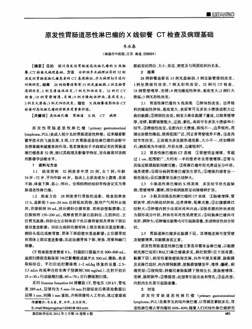 原发性胃肠道恶性淋巴瘤的X线钡餐CT检查及病理基础