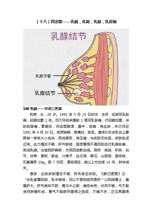 （十八）四逆散——乳癖，乳痈，乳衄，乳房痛