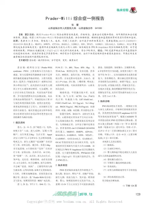 Prader-Willi综合症一例报告