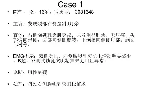 先天性肌性斜颈 PPT