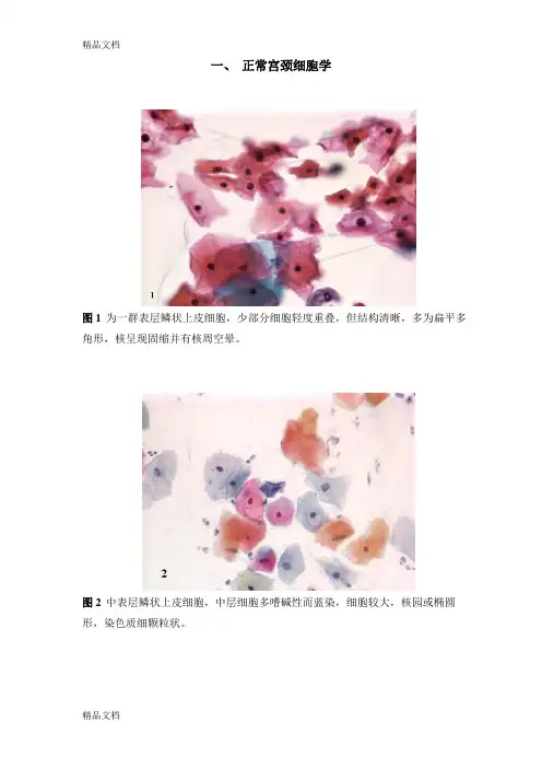(整理)图谱宫颈细胞学.
