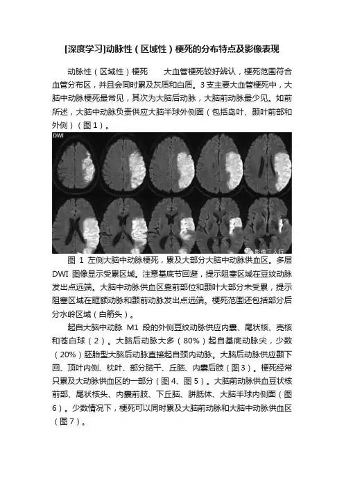 [深度学习]动脉性（区域性）梗死的分布特点及影像表现
