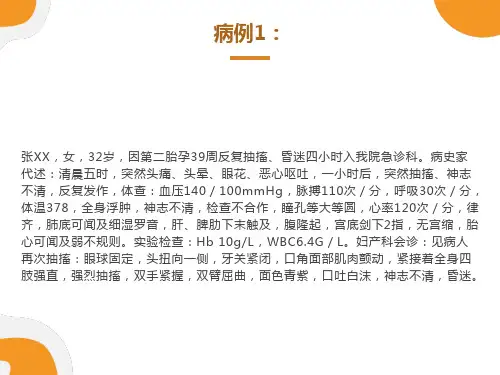 妊娠高血压综合症