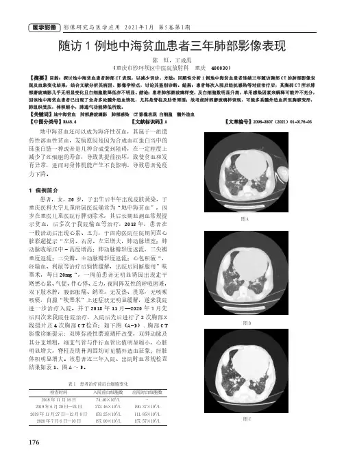 随访1例地中海贫血患者三年肺部影像表现