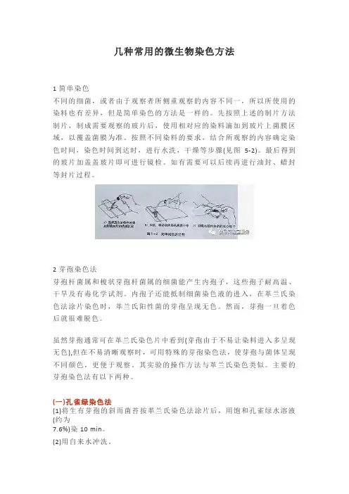 常用的微生物染色方法