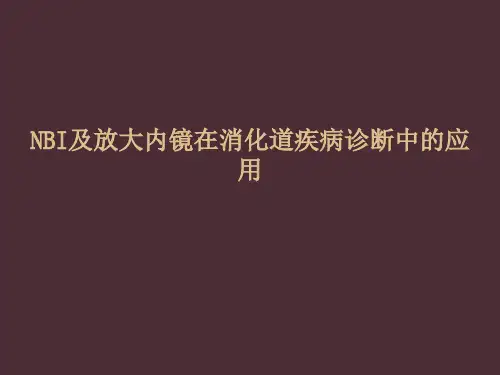 NBI及放大内镜在消化道疾病诊断中的应用