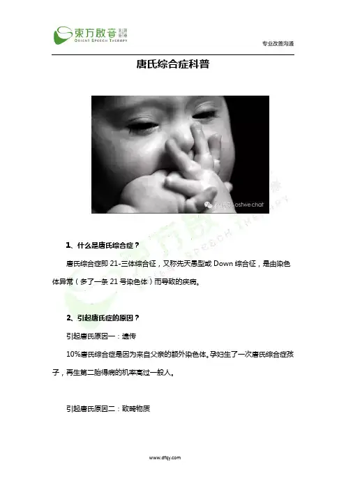 唐氏综合症科普