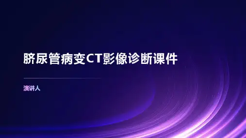 脐尿管病变CT影像诊断课件