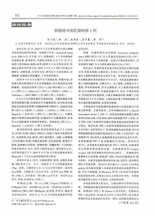 肺腺癌双侧乳腺转移1例
