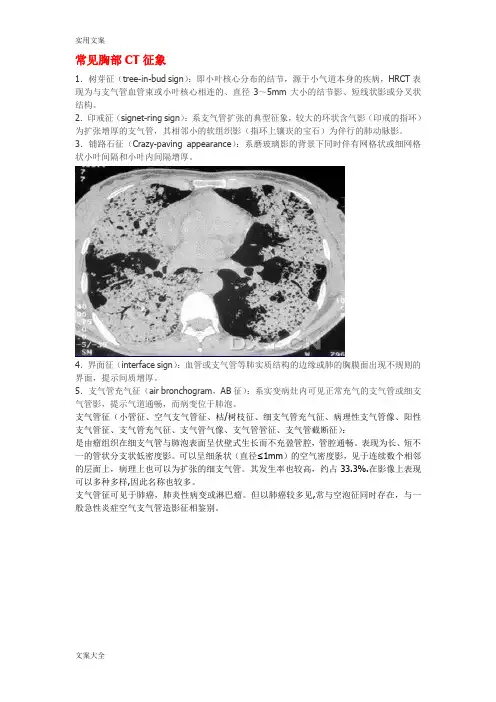 常见胸部CT征象