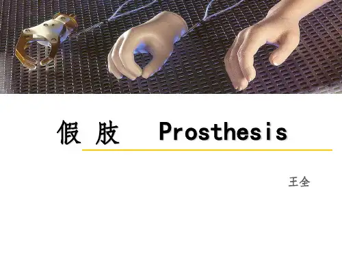 假肢的基本概念