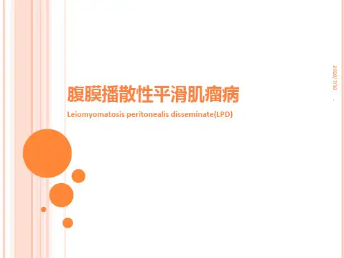 腹膜播散性平滑肌瘤病ppt课件