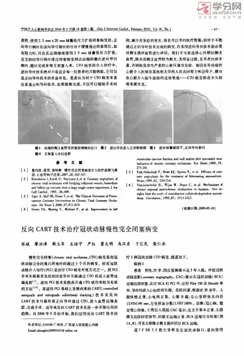 反向CART技术治疗冠状动脉慢性完全闭塞病变（荐）