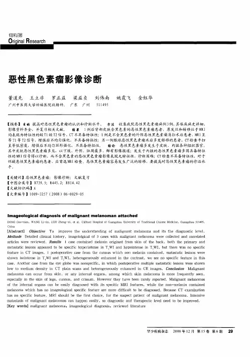 恶性黑色素瘤影像诊断