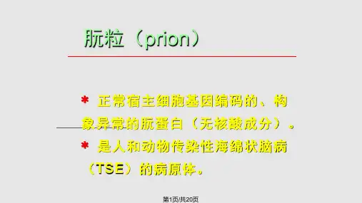 朊粒山东大学医学院赵蔚明教授PPT课件