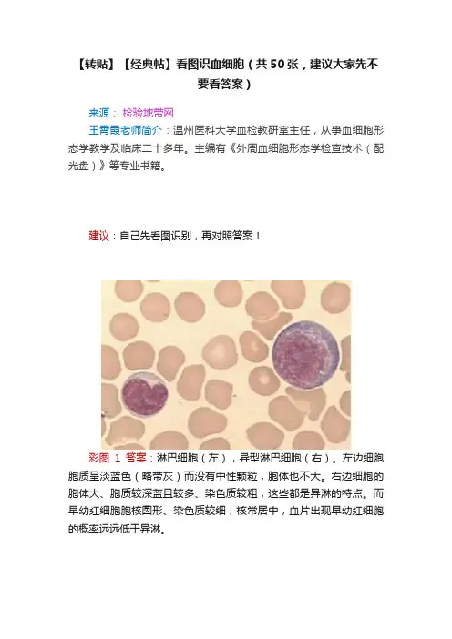 【转贴】【经典帖】看图识血细胞（共50张，建议大家先不要看答案）