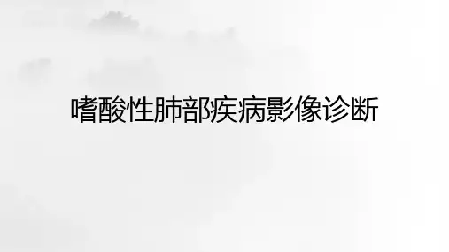嗜酸性肺部疾病影像诊断