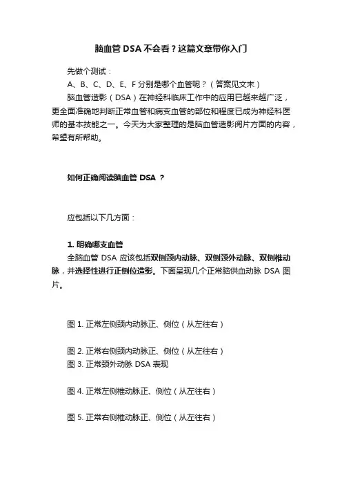 脑血管DSA不会看？这篇文章带你入门