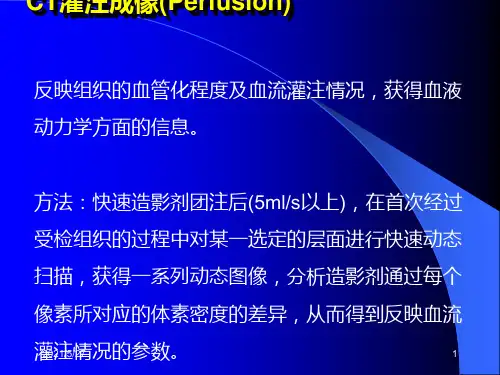 CT灌注成像