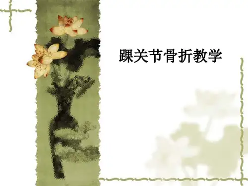 踝关节骨折ppt课件
