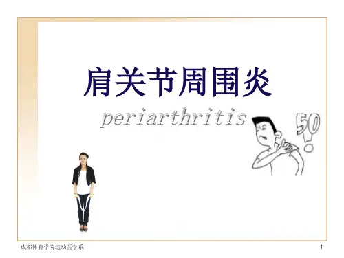 肩周炎.PPT