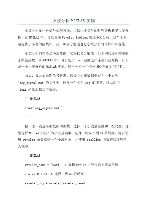 小波分析MATLAB实例