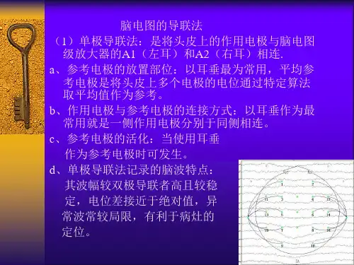 临床脑电图PPT医学课件