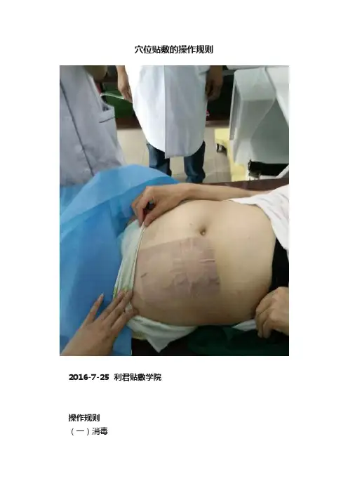 穴位贴敷的操作规则