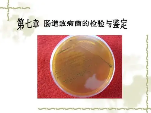 第七章 肠道致病菌的检验与鉴定 PPT课件 