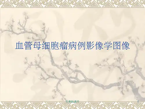 中枢神经系统血管母细胞瘤的影像学图像ppt课件